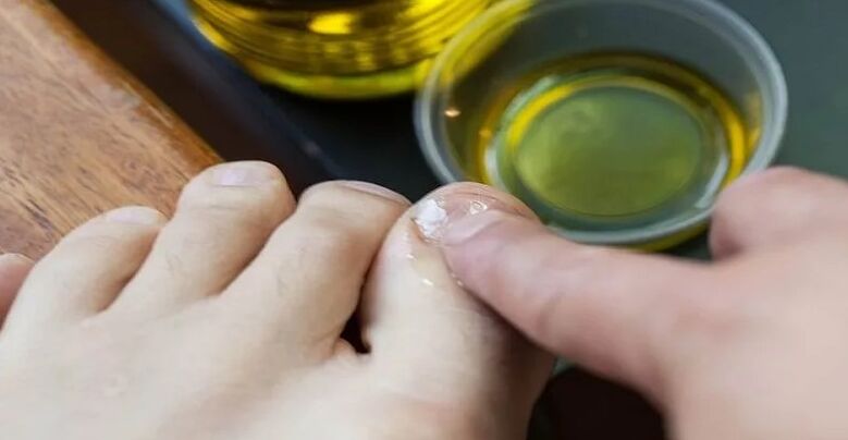 Essential oils to fight mushrooms