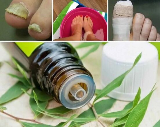 Tea for the nail fungus