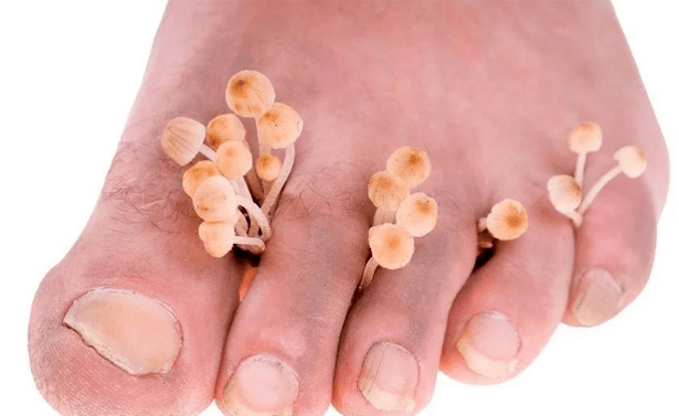 Skin mushroom