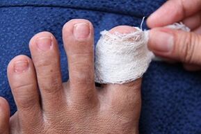 nail fungus compress